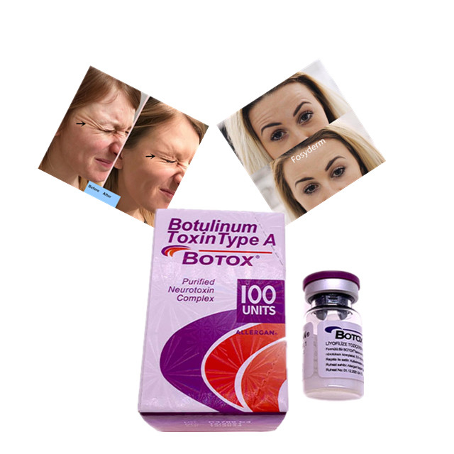 Type botulinum de toxine d'Allergan un acide hyaluronique cutané de remplisseur d'unité de  100
