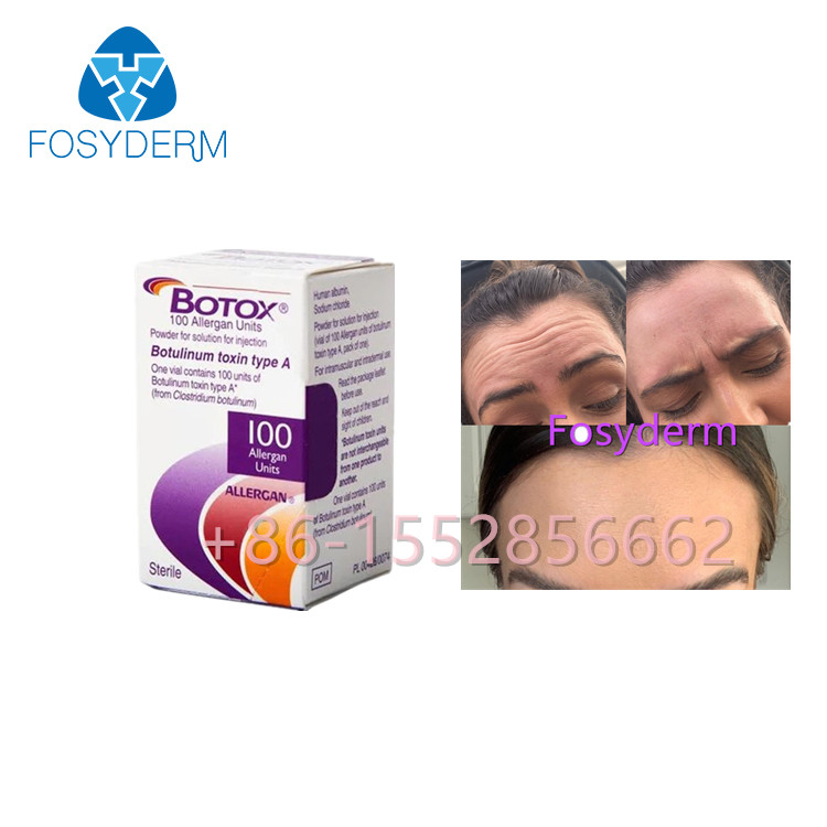 Allergan  100 Unités Toxine Botulique Anti Rides Type A Injection