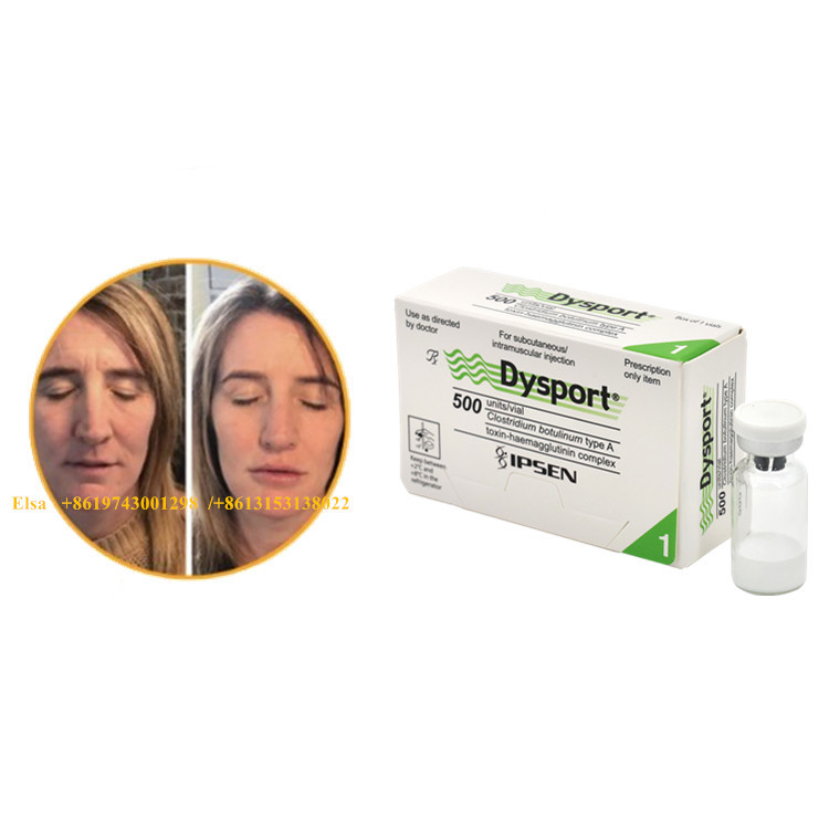 Dysport 500 unités de toxine botulique de type A pour l'élimination des rides