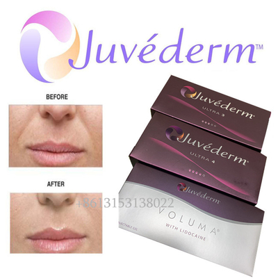 Injection de remplisseur de lèvre d'acide hyaluronique du lidocaïne ultra 3 de Juvederm