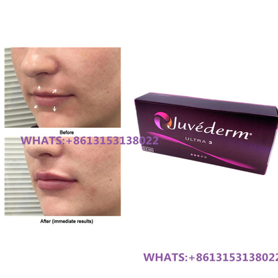 Remplisseur cutané pour lèvres Juvederm Ultra3 Ultra4 Remplisseurs