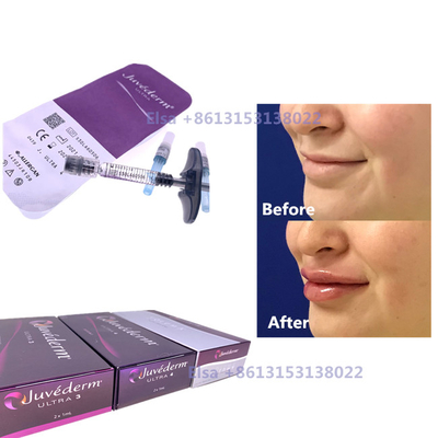 2×1 ml de remplissage cutané injectable Juvederm Syringe Ultra3 Ultra4 Volume
