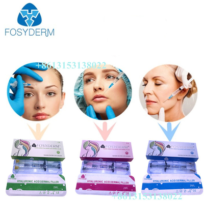 Injection cutanée d'acide hyaluronique de remplisseur de Fosyderm 24mg/ml ha pour le CE de lèvres