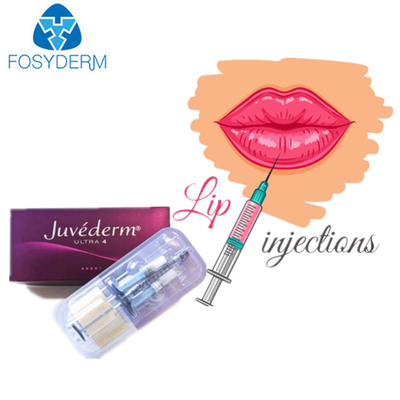 Juvederm remplisseur cutané d'ultra 3 acides hyaluroniques pour des lèvres de visage