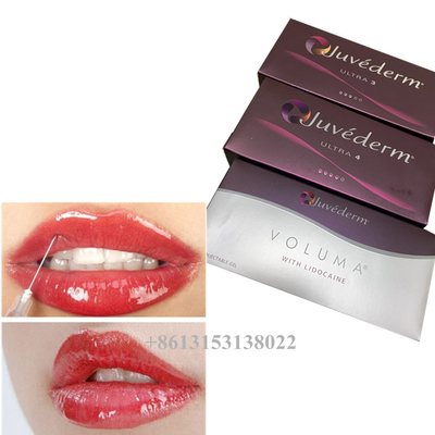 Juvederm Voluma Acide hyaluronique Gel de remplissage cutané 24 mg/ml