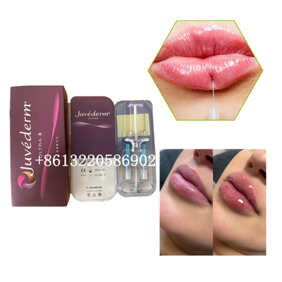 Acide hyaluronique de l'injection 2ml de remplisseur de lèvre d'Ultra3 Juvederm cutané