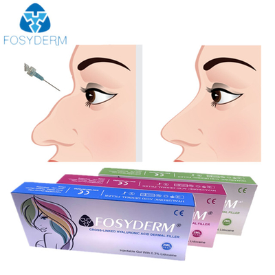 Injection cutanée de remplisseur de nez d'acide hyaluronique 1ml 2ml pour l'usage femelle