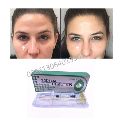 Enlevez la solution composée de Hyaluronate de sodium foncé des cercles 1ml
