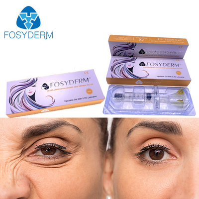 l'injection cutanée de remplisseur de Fosyderm de l'acide hyaluronique 5ml pour des lèvres flairent