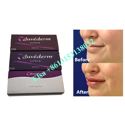 Voluma Acide Hyaluronique Fosyderm Injection de Remplissage Dermique 24mg/Ml