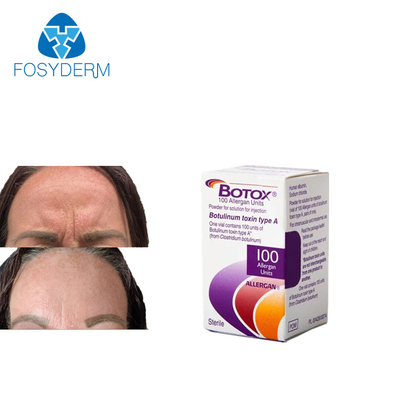 Anti Rides  De Allergan 100 Unités Injection
