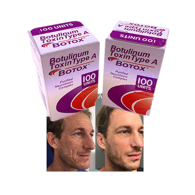 Poudre d'injection de  Allergan Cosmetics anti-âge anti-rides 100 unités