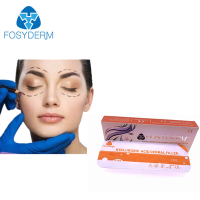 Remplisseur cutané durable d'acide hyaluronique de Fosyderm pour l'injection cosmétique