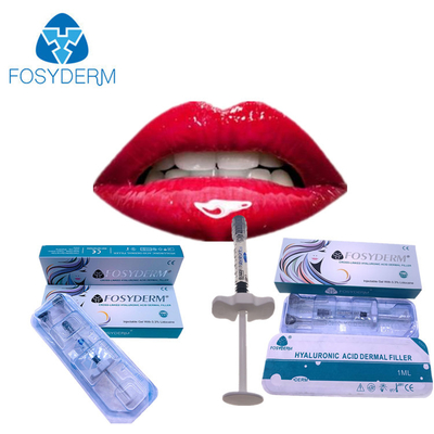 Une injection plus dodue Fosyderm 1ml Derm de remplisseur d'ha de lèvres