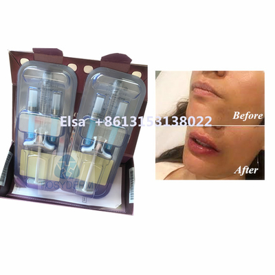 Produit de beauté Juvederm Voluma Acide hyaluronique Remplisseur facial HA Injection