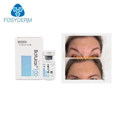 Enlevez ride Botulax que 100 unités dactylographient une injection botulinum de toxine