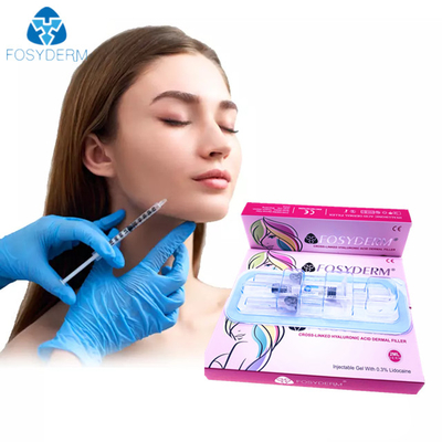 Lèvres cutanées de remplisseur d'acide hyaluronique de Fosyderm injectables