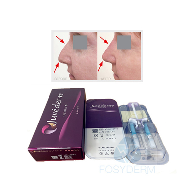 La lèvre de visage a réticulé le gel cutané d'acide hyaluronique de Juvederm Ultra3 de remplisseur
