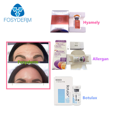 100 unités dactylographient une toxine botulinum Allergan que l'anti massage facial ride l'injection de  Botulax
