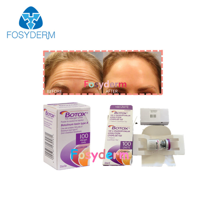 anti injection botulinum TypeA  d'Allergan de toxine de la ride 100Units