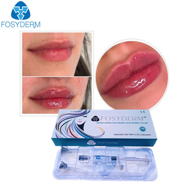 Massage facial de gel d'acide hyaluronique de Fosyderm l'anti ride l'injection cutanée de remplisseurs