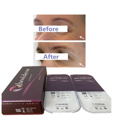 Juvederm 2ml Ultra3 Ultra4 Voluma Acide Hyaluronique Dermal Filler Lip Filler 24mg