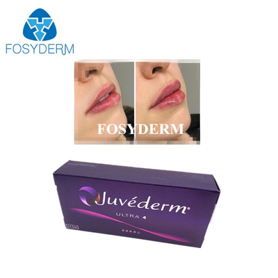 L'acide hyaluronique coréen lié au remplissage cutané Juvederm Lip Filler Injections