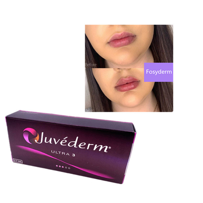 2 ml Juvederm Acide hyaluronique Remplisseur cutané Remplisseur de rides Chin Lips Ultra 3