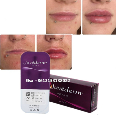 Cosmétiques soins de la peau Injections Plumper labiale Juvederm Filler Injection Pour le nez et le menton