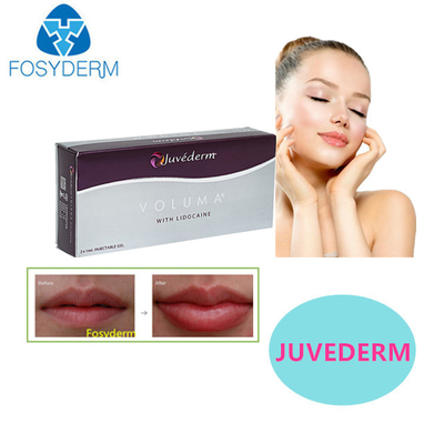 Acide hyaluronique pour les lèvres sexy 24 mg pour le visage