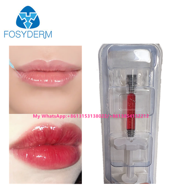 Produit de comblement des lèvres rouge à base d'acide hyaluronique avec vitamine B12 pour les lèvres 1 ml