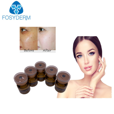 sérum de 20mg/ml 5ml Mesotherapy blanchissant la solution meso