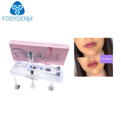 injection cutanée de lèvre de l'acide hyaluronique 1ml de remplisseurs de 0.28mm ha