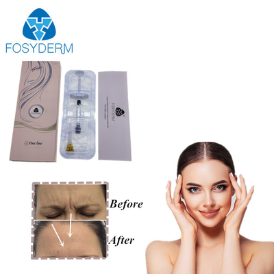 Injection cutanée d'ha de renforceur de lèvre de remplisseur d'acide hyaluronique facial
