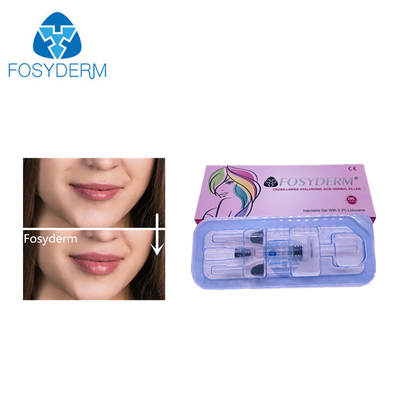 2 ml de remplissage Acide hyaluronique Remplisseur cutané pour l' agrandissement du visage, du nez et des lèvres 24 mg/ ml