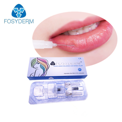 croix injectable de 2ml BDDE liant l'injection de remplisseur d'acide hyaluronique pour le volume de lèvre