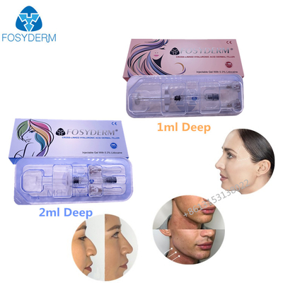 Remplisseur cutané de gel injectable d'acide hyaluronique lié par croix 1ml 2ml pour la peau faciale de lèvres