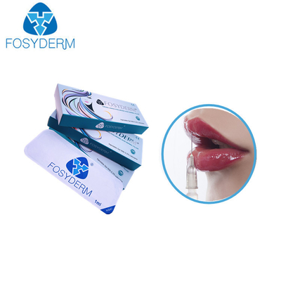 1,1 ml de Derm d'acide hyaluronique de remplisseurs de lèvres de mg de l'amélioration 24 avec du lidocaïne