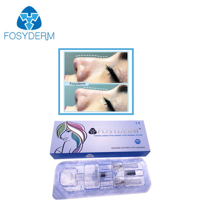 ligne profonde de 2 ml remplisseur cutané d'acide hyaluronique pour le nez avec du lidocaïne