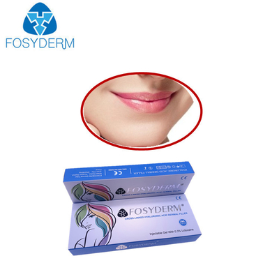 Le sourire raye la ligne cutanée remplisseurs cutanés de Derm de volume de remplisseur d'acide hyaluronique de lidocaïne de Lyft