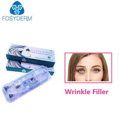 Injections faciales de 1,1 ml pour le remplisseur cutané d'ha de rides