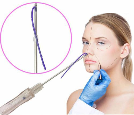 Fil MONO de levage de visage d'ascenseur de fil de la vis PDO de la Corée Pdo avec l'aiguille