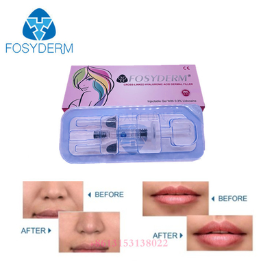 La ride faciale ha gélifient le remplisseur injectable d'acide hyaluronique de remplisseur cutané pour des lèvres