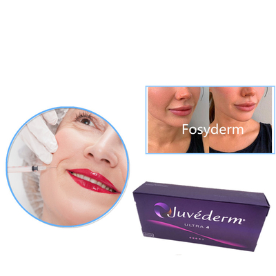 Juvederm ultra 3 ultra 4 injection cutanée de gel de remplisseur de Voluma ha