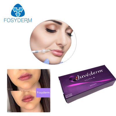 Remplisseur cutané 24mg/Ml de lèvre de Juvederm de gel de remplisseur d'acide hyaluronique d'Ultra3 Ultra4 Voluma