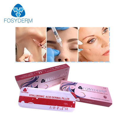 Joue de suffisance de lèvre soulevant le remplisseur cutané facial Fosyderm injectable 2ml d'ha